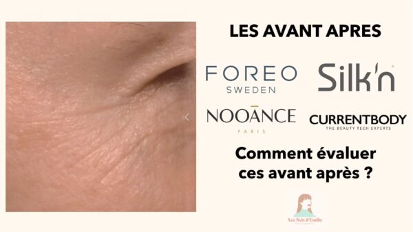 article avant apres masque led