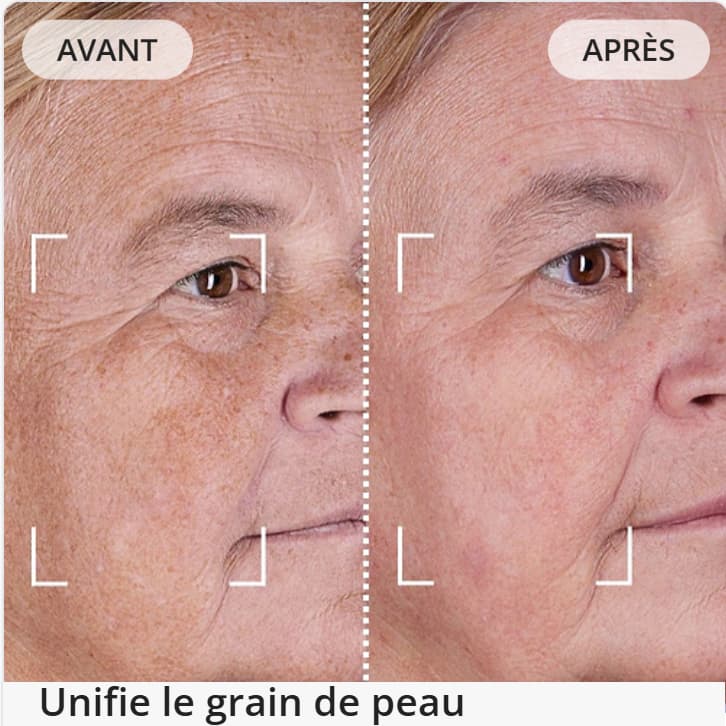 CurrentBody ou Nooance : Mon comparatif détaillé avec test et analyse de leurs masques à LED 11 avant apres grain peau currentbody