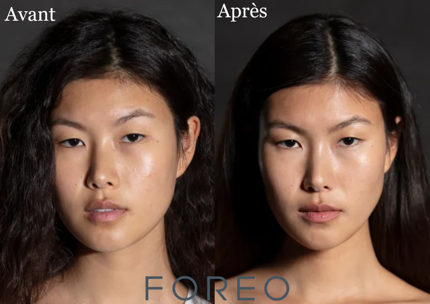 Les avant après des meilleurs masques à LED pour visage : lequel est le plus convaincant ? 4 avant apres masque led foreo 1