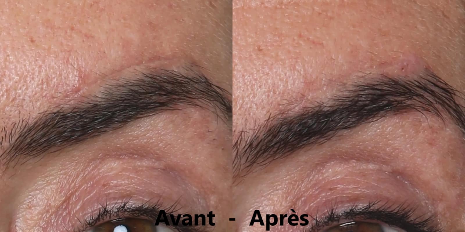 Mon avis sur le masque Silk'n Analyse complète avec résultats et comparatif 7 avant apres masque silkn sourcils 1
