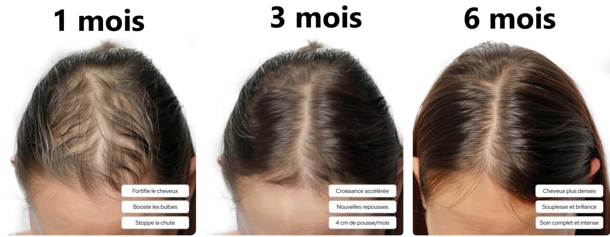 Je teste Mykaracare : Mon avis avec analyse complète des ingrédients 9 avant apres my karacare