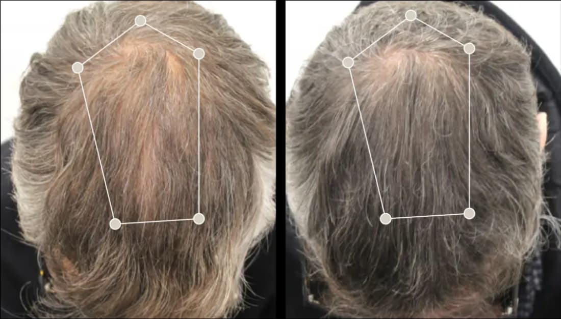 Avis sur Oma & Me Mon analyse complète du protocole avec test personnel 12 avant apres oma me client 1 1