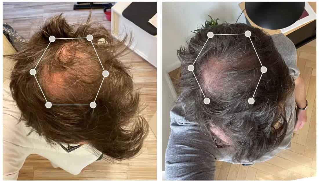 Avis sur Oma & Me Mon analyse complète du protocole avec test personnel 13 avant apres oma me client 2 1