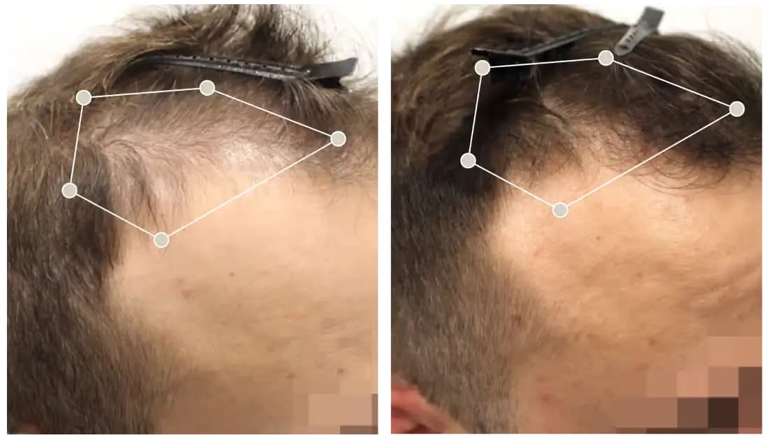 Avis sur Oma & Me Mon analyse complète du protocole avec test personnel 11 avant apres oma me client 3 1