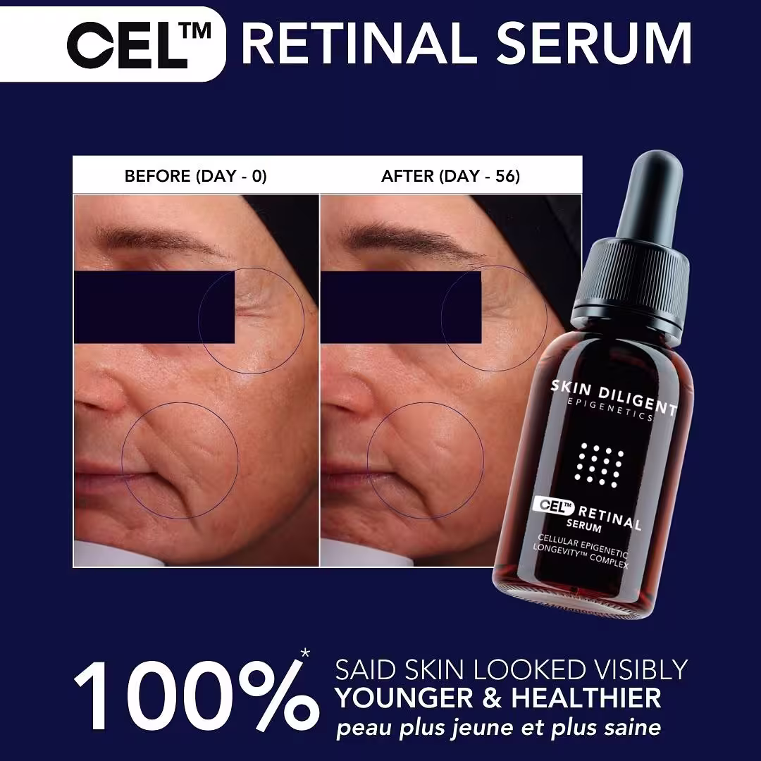 Mon avis sur le sérum au rétinal de Skin Diligent : vraiment efficace ? 1 exemple visuel effets serum retinal peau visage anti age