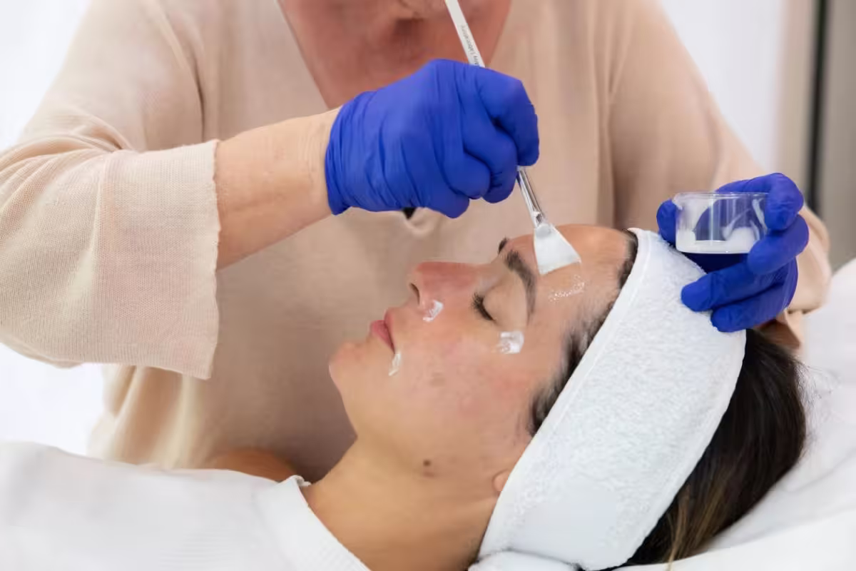 Cicatrices d'acné : les meilleurs soins pour les atténuer 6 seance peeling institut cicatrice acne