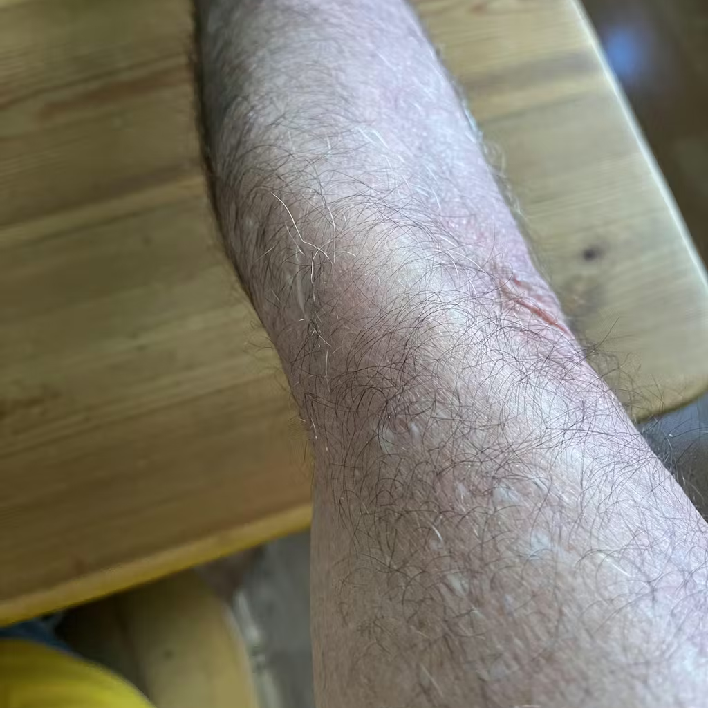 apres cure officine du monde traitement psoriasis