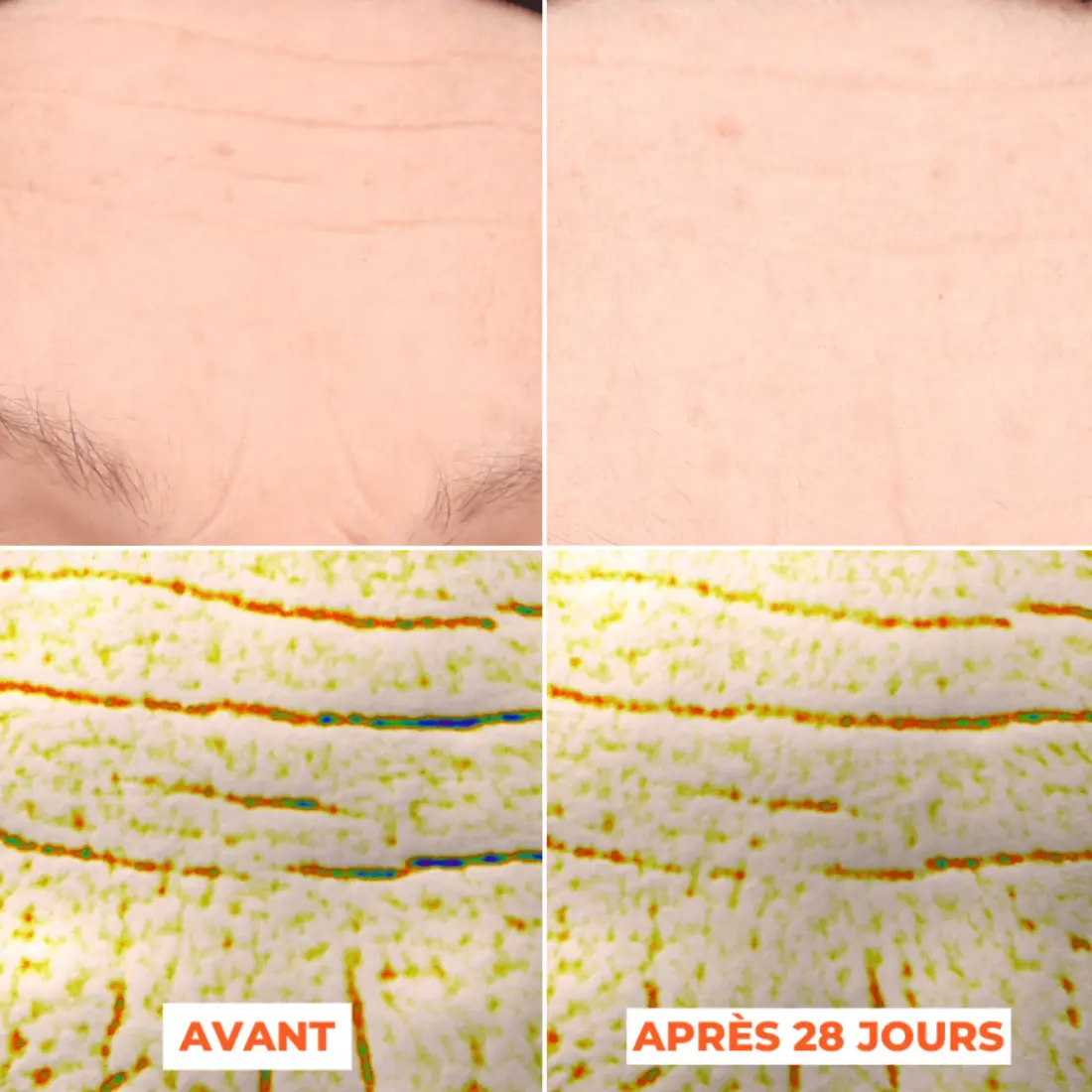 Mon avis sur Laboratoires Dermeden : j'ai testé 4 soins complet 9 avant apres dermeden diminution profondeur rides avis