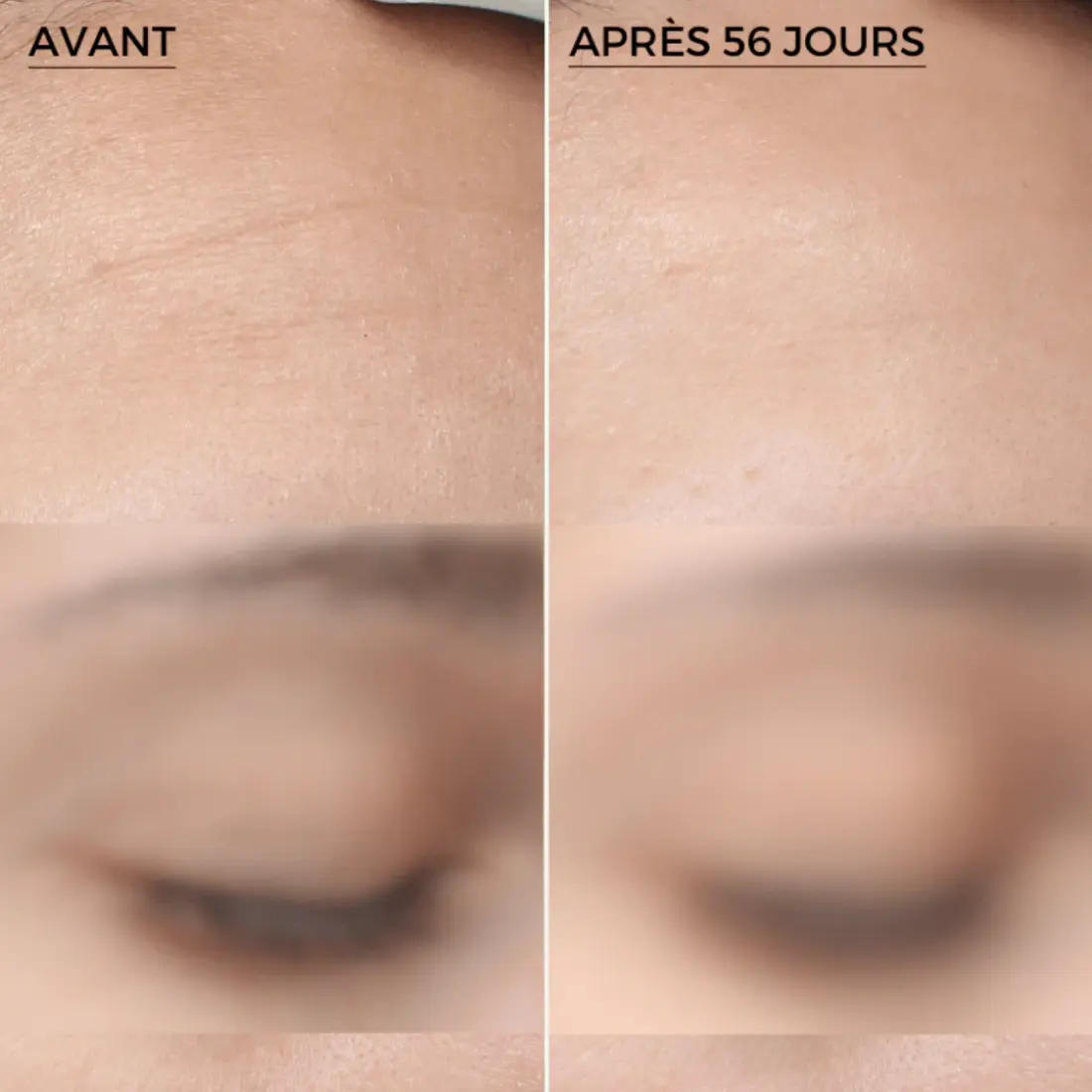 Mon avis sur Laboratoires Dermeden : j'ai testé 4 soins complet 10 avant apres gommage ridules front dermeden avis