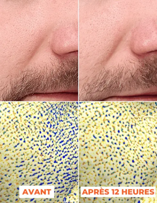 Mon avis sur Laboratoires Dermeden : j'ai testé 4 soins complet 2 exemple avant apres mesures instrumentales laboratoires dermeden