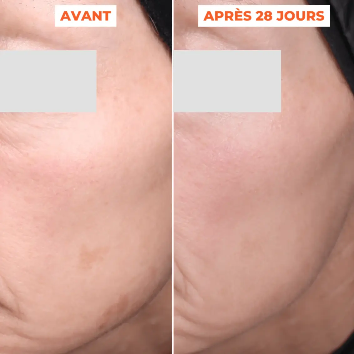 Mon avis sur Laboratoires Dermeden : j'ai testé 4 soins complet 11 reduction taches brunes visage dermeden avant apres avis