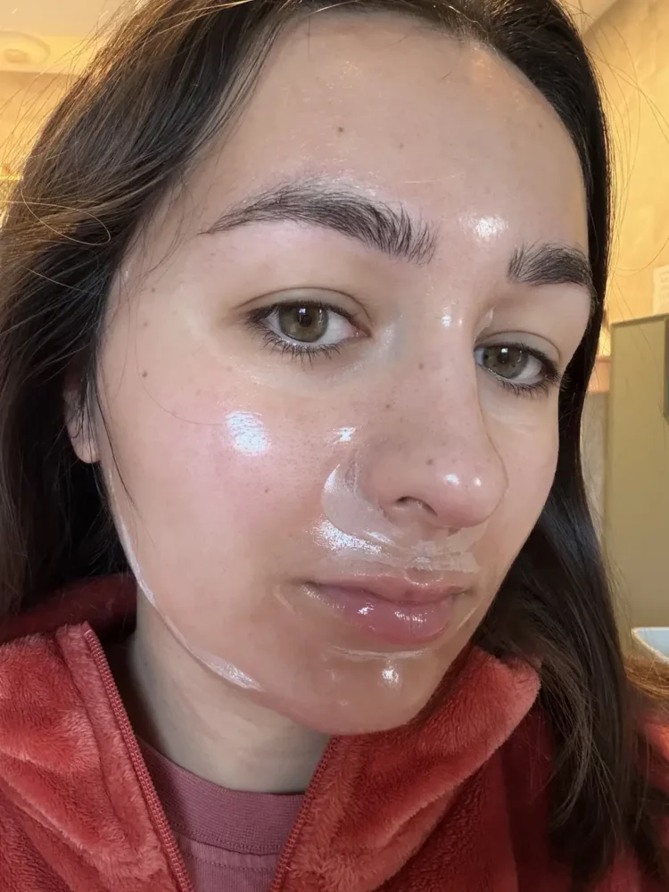 Biodance ou Medicube : quel masque collagène choisir ? 1 apres pose masque medicube visage lesavisdemilie (1)