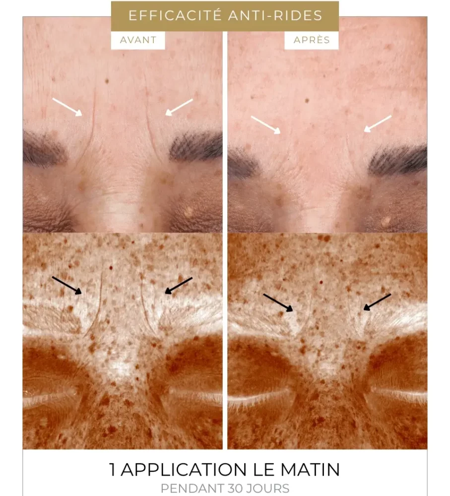 J'ai testé le protocole Vitamine C- Powder Flash de Dermeden : Mon Avis 8 avant apres rides dermeden resultats etude