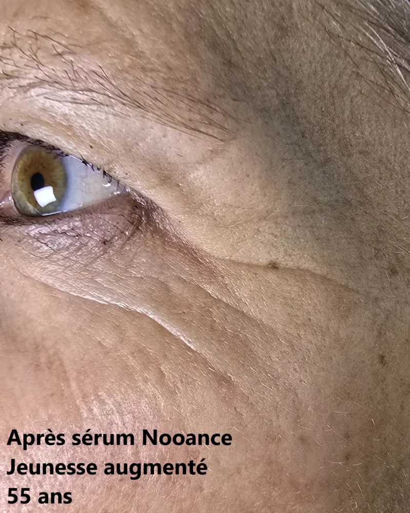 J'ai testé le Sérum Jeunesse Augmenté Nooance : mon avis après 30 jours de test 9 avant apres mere soixantaine photo apres serum jeunesse nooance resultat rides patte oie