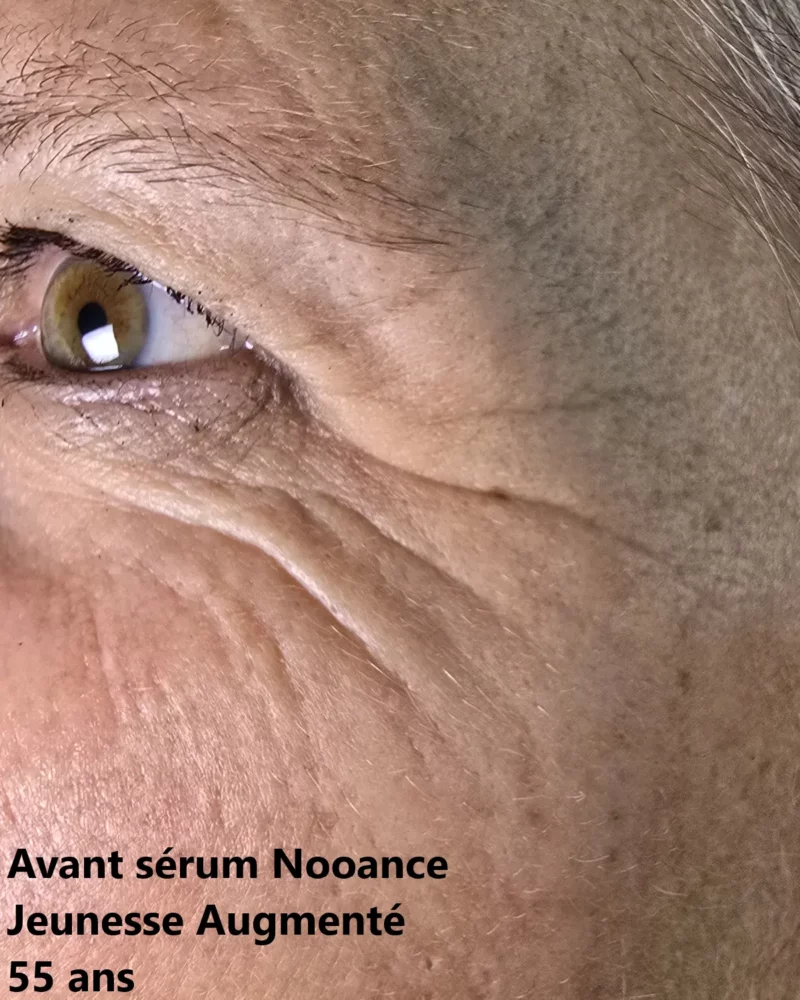 J'ai testé le Sérum Jeunesse Augmenté Nooance : mon avis après 30 jours de test 8 avant apres mere soixantaine photo avant serum jeunesse nooance